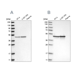 Fumarase Antibody in Western Blot (WB)