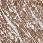 PDK1 Antibody in Immunohistochemistry (Paraffin) (IHC (P))