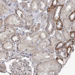 PDK1 Polyclonal Antibody