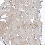 PDK1 Antibody in Immunohistochemistry (Paraffin) (IHC (P))