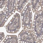 PDK1 Antibody in Immunohistochemistry (Paraffin) (IHC (P))
