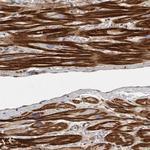 ORP9 Polyclonal Antibody