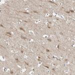 ORP9 Antibody in Immunohistochemistry (Paraffin) (IHC (P))
