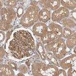 ORP9 Antibody in Immunohistochemistry (Paraffin) (IHC (P))