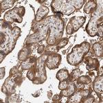 ORP9 Antibody in Immunohistochemistry (Paraffin) (IHC (P))