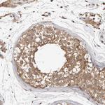 ORP9 Antibody in Immunohistochemistry (Paraffin) (IHC (P))