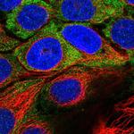 USH1C Polyclonal Antibody