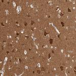 BAIAP2 Antibody in Immunohistochemistry (Paraffin) (IHC (P))