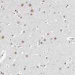 ORC1 Antibody in Immunohistochemistry (Paraffin) (IHC (P))