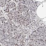 ORC1 Antibody in Immunohistochemistry (Paraffin) (IHC (P))