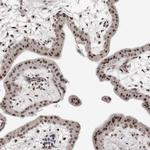 ORC1 Antibody in Immunohistochemistry (Paraffin) (IHC (P))