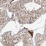 ORC1 Antibody in Immunohistochemistry (Paraffin) (IHC (P))