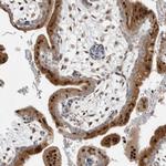 NAB2 Antibody in Immunohistochemistry (Paraffin) (IHC (P))