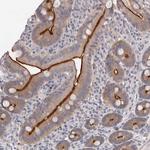 USH1C Polyclonal Antibody