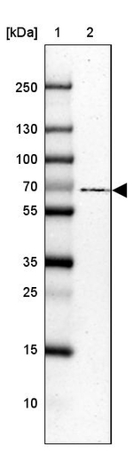 USH1C Antibody in Western Blot (WB)
