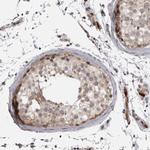 EphA10 Polyclonal Antibody