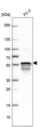 Annexin A11 Antibody in Western Blot (WB)