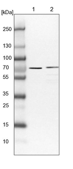 PPP2R5C Antibody in Western Blot (WB)