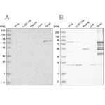PKP1 Antibody in Western Blot (WB)