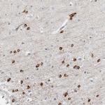 HIPK4 Polyclonal Antibody