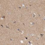 HIP55 Antibody in Immunohistochemistry (Paraffin) (IHC (P))