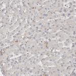 HIP55 Antibody in Immunohistochemistry (Paraffin) (IHC (P))