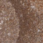 HIP55 Antibody in Immunohistochemistry (Paraffin) (IHC (P))