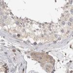 HIP55 Antibody in Immunohistochemistry (Paraffin) (IHC (P))