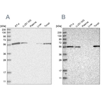 HIP55 Antibody in Western Blot (WB)