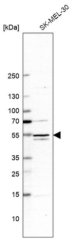 MEK5 Antibody in Western Blot (WB)