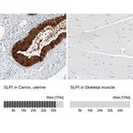 SLPI Antibody