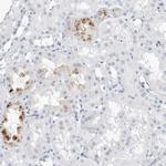 SLPI Antibody in Immunohistochemistry (Paraffin) (IHC (P))