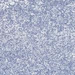 SLPI Antibody in Immunohistochemistry (Paraffin) (IHC (P))