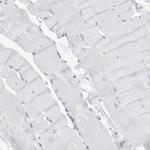 SLPI Antibody in Immunohistochemistry (Paraffin) (IHC (P))