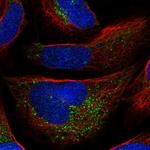 AZIN1 Polyclonal Antibody