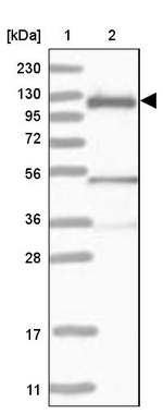 c-Cbl Antibody in Western Blot (WB)