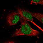 GSK3B Polyclonal Antibody