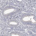 Spectrin alpha-1 Antibody in Immunohistochemistry (Paraffin) (IHC (P))