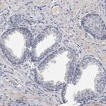 Spectrin alpha-1 Antibody in Immunohistochemistry (Paraffin) (IHC (P))