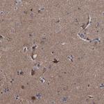 DTNBP1 Antibody in Immunohistochemistry (Paraffin) (IHC (P))