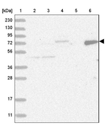 LIMK1 Antibody in Western Blot (WB)