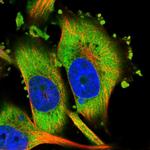 HIPK3 Polyclonal Antibody