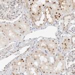 HIPK3 Antibody in Immunohistochemistry (Paraffin) (IHC (P))