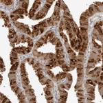 NUDC Antibody in Immunohistochemistry (Paraffin) (IHC (P))