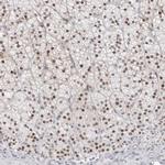 C1orf57 Polyclonal Antibody