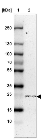 C1orf57 Antibody in Western Blot (WB)