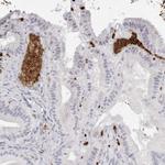 Spectrin alpha-1 Polyclonal Antibody