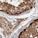 RBKS Antibody in Immunohistochemistry (Paraffin) (IHC (P))