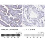 CCDC17 Antibody