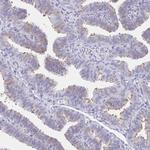 CCDC17 Antibody in Immunohistochemistry (Paraffin) (IHC (P))